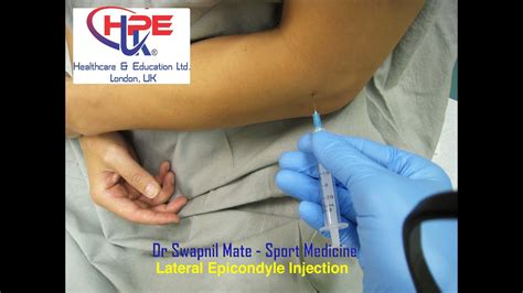 Tennis Elbow Injection Therapy YouTube