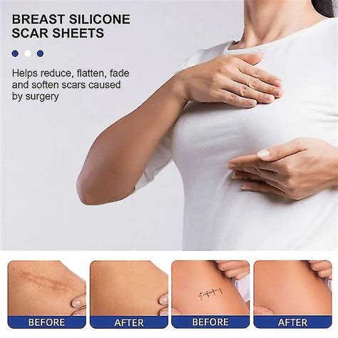 Silicone Scar Sheets Silicone Scar Sheets For Breast 8 Pack Breast