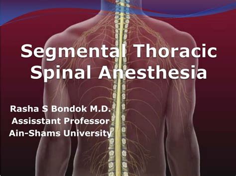 Ppt Segmental Thoracic Spinal Anesthesia Powerpoint Presentation