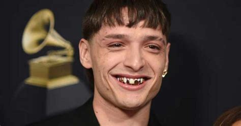 Peso Pluma Y Su Costosa Dentadura Que Sorprendi A Todos En Los Grammy