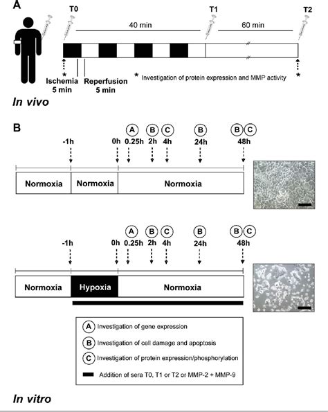 Figure From Serum From Patients Undergoing Remote Ischemic