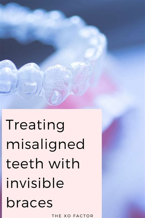 Treating Misaligned Teeth With Invisible Braces The Xo Factor