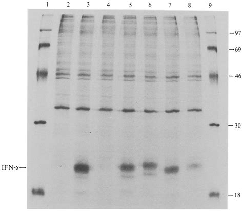 Fluorograph Of An Sds Polyacrylamide Gel Containing 35s Labelled