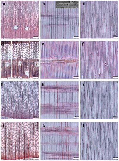 Forests Free Full Text Ray Traits Of Juvenile Wood And Mature Wood