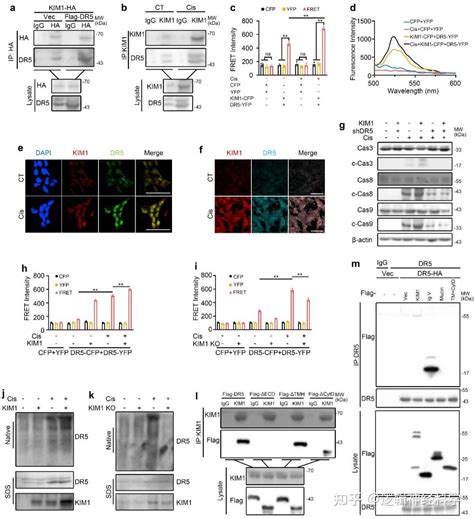 Nat Commun︱武汉大学郑凌华中科技大学黄昆课题组联合发现肾脏yy1 Kim1 Dr5轴调控急性肾损伤进展 知乎