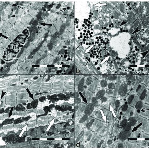 Electron Micrograph Of The Atrium ×10 000 A Control Group Atrial