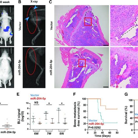 Upregulating MiR 204 5p Represses Bone Metastasis Of PC 3 Cells In Vivo