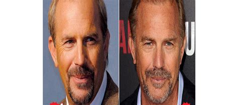 13+ Kevin Costner Hair Transplant - AshlynnOran