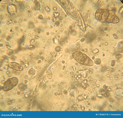 Alternaria Fungus Spores Under The Microscope Stock Photography ...