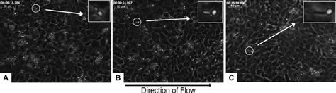 Still Images Of Yeast A Pseudohyphal B And Hyphal C Forms Of