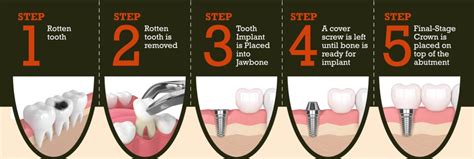 tooth  dying step  step guide taft independent