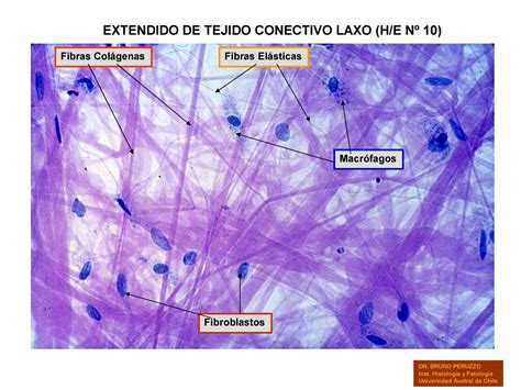 Tejido Conjuntivo Fibroblastos Tejido Conectivo Images And Photos Finder