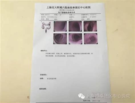 实用超详细给大肠癌筛查患者的肠镜检查全攻略