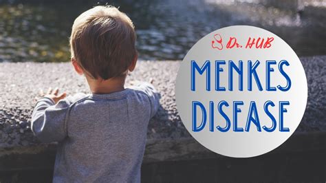 Menkes Disease Youtube