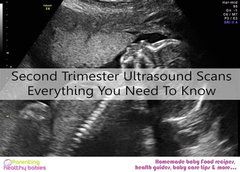 Second Trimester Ultrasound Scans: Everything You Need To Know