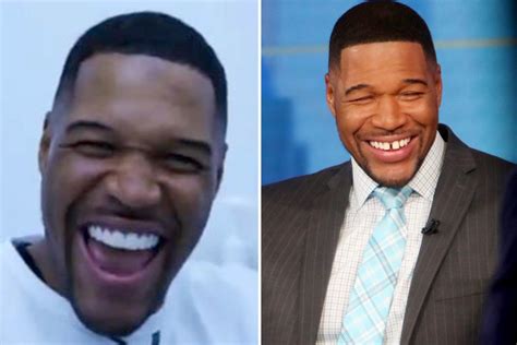 What happened to Michael Strahan's teeth?