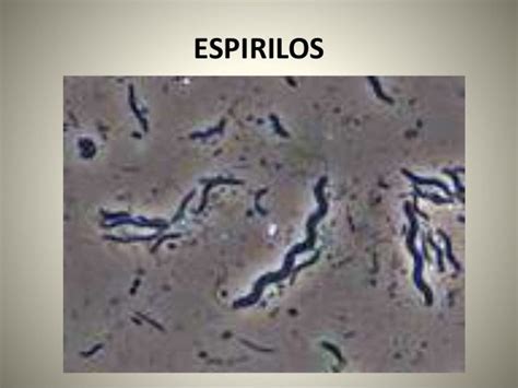 Dominio Bacteria Espirilo