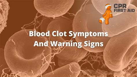 Blood Clot Symptoms And Warning Signs CPR First Aid