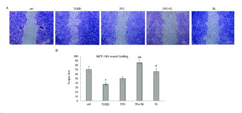 Wound-healing assay in MCF-10A cells. (A) Representative phase-contrast ... 
