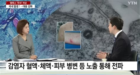 엠폭스란 엠폭스 원숭이두창 원인 증상 감염경로 감염원인 알아보기