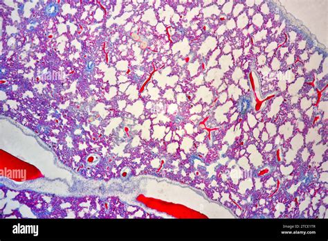 Human Lung Section Showing Alveoli Bronchiole And Blood Vessels