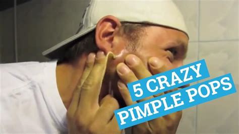 5 of the craziest pimple pops | Herald Sun