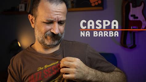 Como Acabar De Vez A Caspa Na Barba Youtube