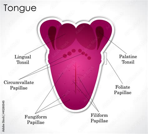 Lingual Tonsils Picture : Figure 1 From Factors Associated With ...