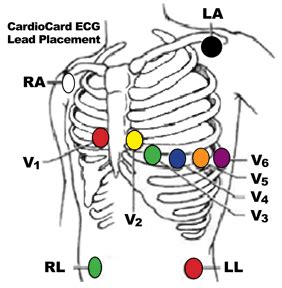 12 Lead Ecg Placement Mnemonic