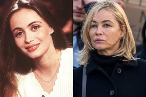 Toutes Ces Stars Françaises Ont Eu Recours à La Chirurgie Esthétique Et