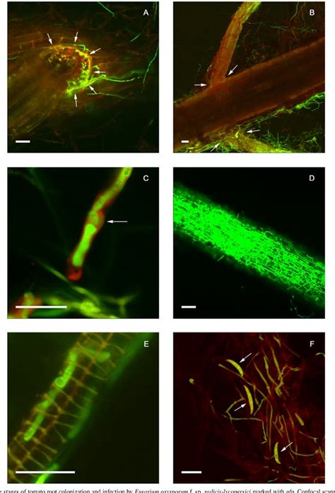 Figure 4 From Novel Aspects Of Tomato Root Colonization And Infection