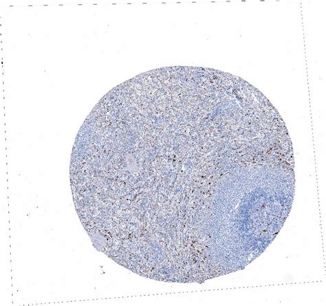 Tissue Expression Of Cd68 Staining In Spleen The Human Protein Atlas