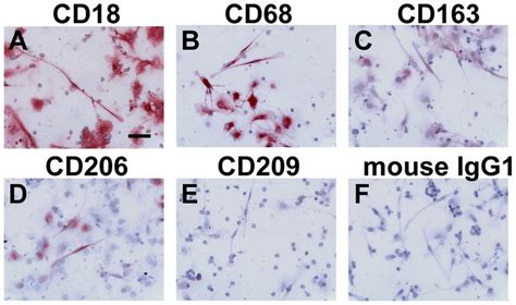 Expression of monocyte/macrophage markers on fibrocytes. PBMC were ...