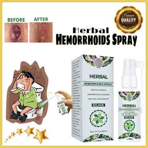 Herbal Hemorrhoids Spray 100 Guaranteed Safe And Effective Treatment