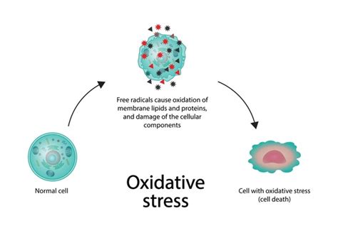 chronic diseases oxidative stress stock vectors  vector art