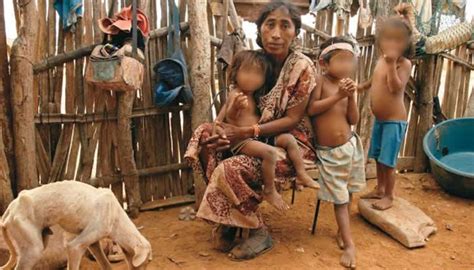 Niños desnutridos y sin educación en La Guajira La Otra Cara