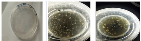 Macroscopic Appearance Of Colonies Isolated From Fish Dilution10 1