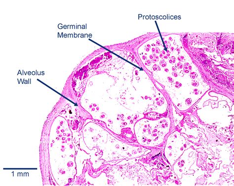 Echinococcus Multilocularis Learn About Parasites Western College Of Veterinary Medicine