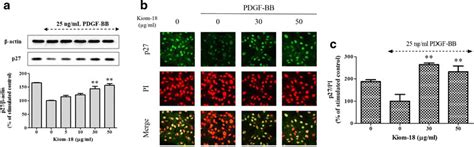 Effect Of Kiom Extract On The Degradation Of P Kip Expression