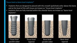 Lecture BDS IV Implant Dentistry PPT