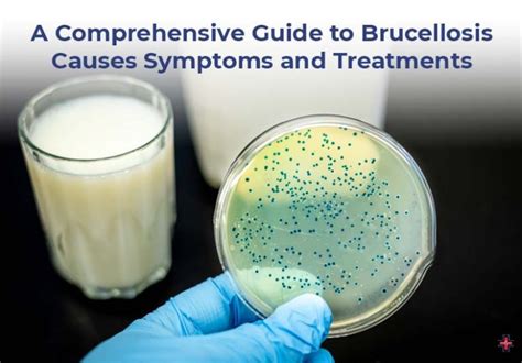 A Comprehensive Guide To Brucellosis Causes Symptoms And Treatments Er Of Mesquite