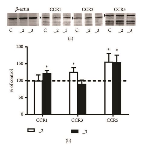 Western Blot Analysis Of Ccrs Protein In Pc12 Cell Lines A