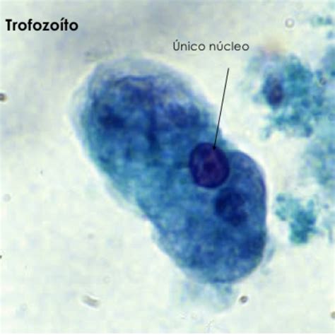 Entamoeba Histolytica Parasitologia