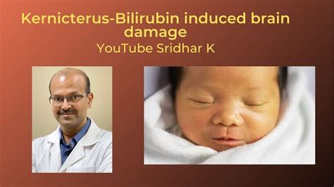 Kernicterus And Bind Bilirubin Induced Neurologic Damage Dr Sridhar