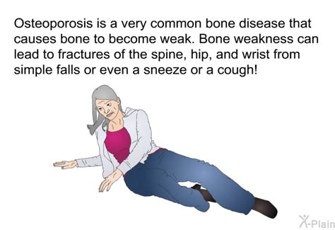 Patedu Osteoporosis