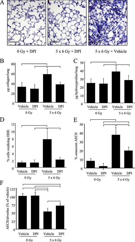 Effect Of Nadph Oxidase Nox Inhibition On Radiation Fibrosis And Type