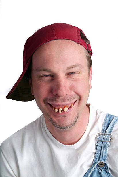 100 Toothless Hillbilly Stock Photos Pictures And Royalty Free Images