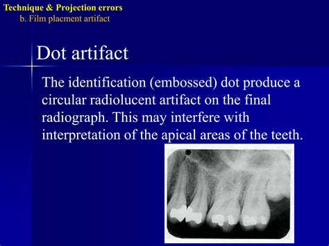 Radiographic errors and artifacts | PPTX