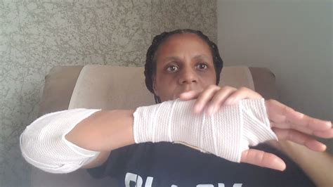 Carpal Tunnel And Cubital Tunnel 3 Days After Surgery Youtube