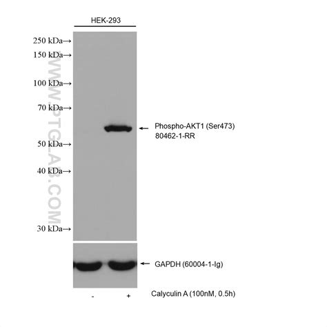 Phospho Akt1 Ser473 Antibody 80462 1 Rr Proteintech 武汉三鹰生物技术有限公司